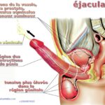 Ejaculation précoce kit Antechinus : traitement naturelle