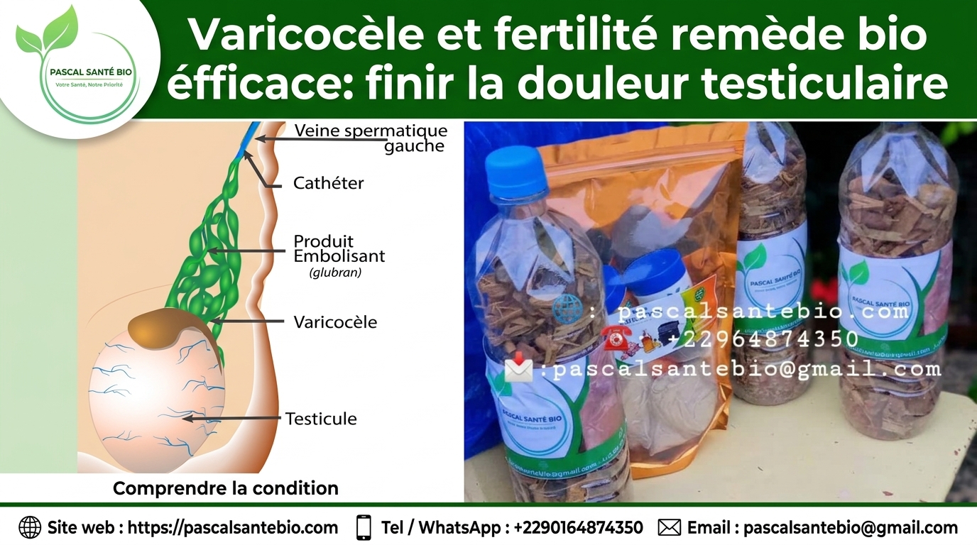 Varicocèle remède bio