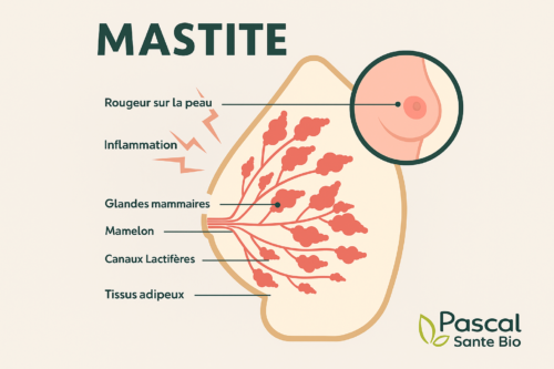 inflammation mammaire femme