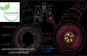 Diagnostiquer et Traiter l’Asthme efficacement