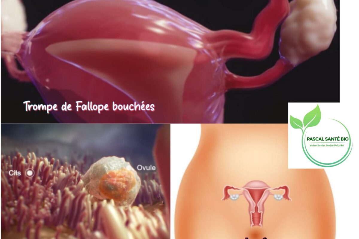 Remède efficace pour déboucher trompe de Fallope naturellement