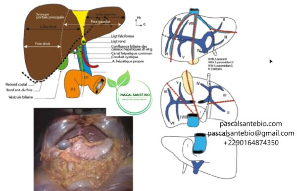 Nodule hépatique ou foie traitement naturel et définitif