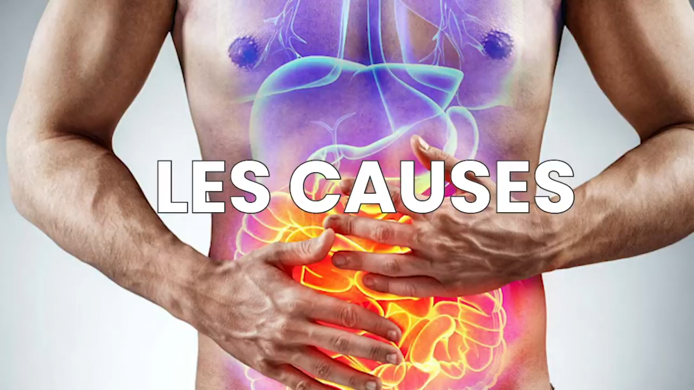 Guérir définitivement avec plantes la maladie de crohn