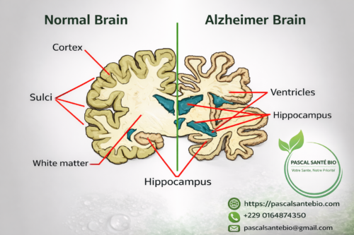 Remèdes naturels contre la perte de mémoire Alzheimer