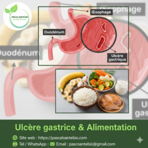 Ulcère gastrique solution naturel