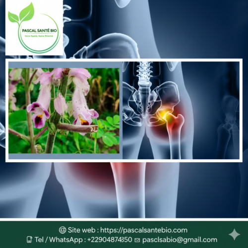 Arthrose Causes et Traitements