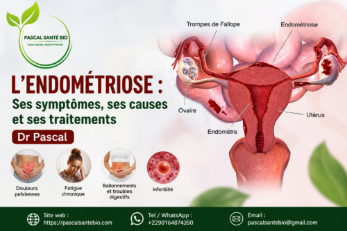 Remède naturel contre l’endométriose